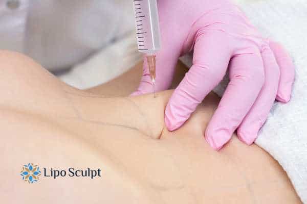 Aqualyx for Muffin Tops: What to Know Before Fat-Dissolving Injections 4 Are there risks Burbage?